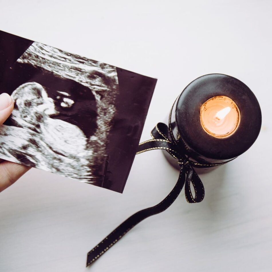 Duelo Gestacional Duelo Perinatal Psicóloga Perintal