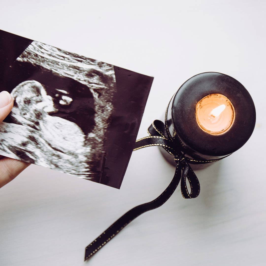 Duelo Gestacional Duelo Perinatal Psicóloga Perintal